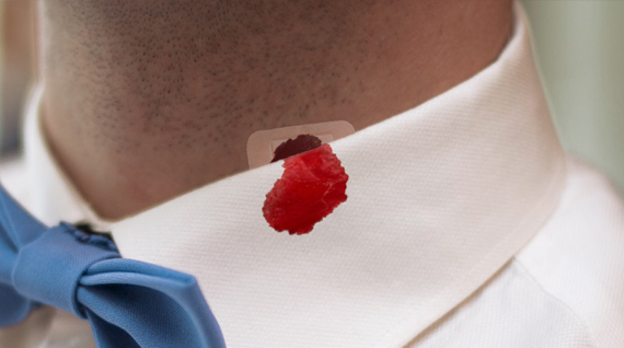 how to remoe blood stains